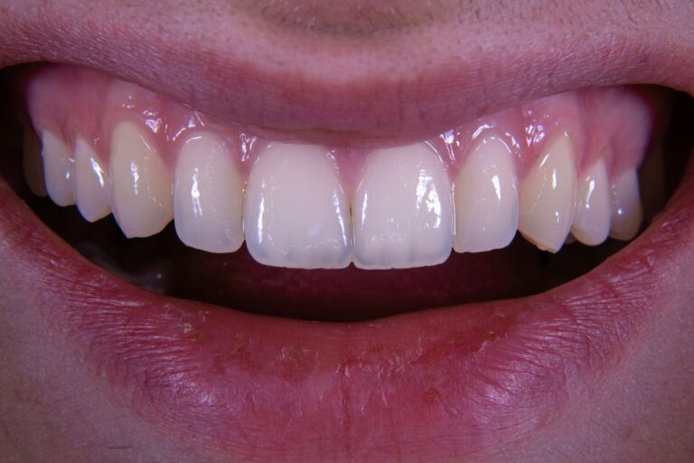 When Prices Don’t Match Costs: The Case of High‑Priced Dentistry